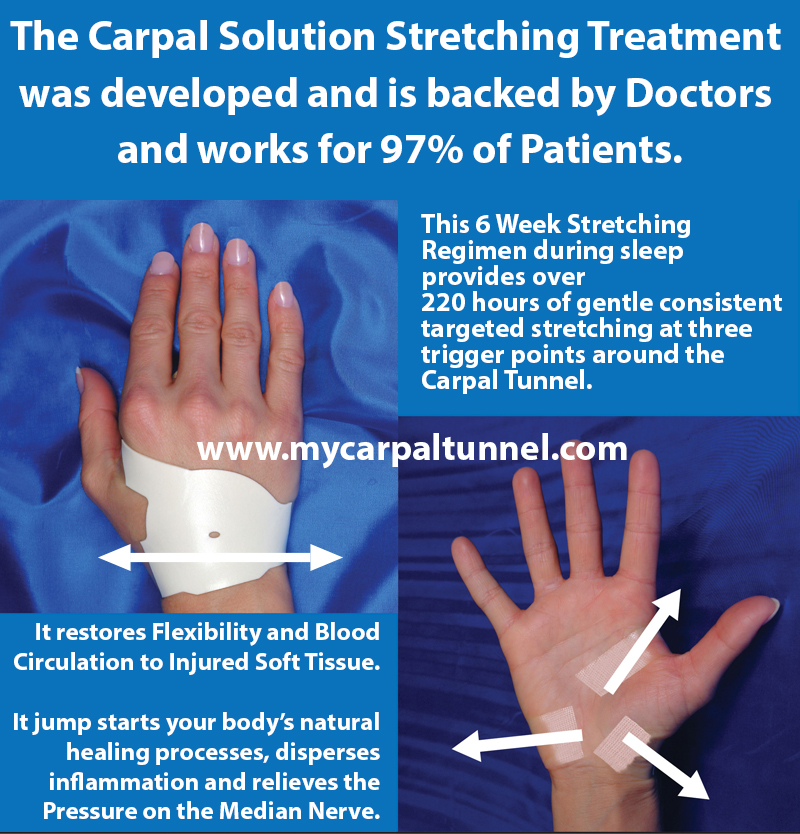 the carpal solution stretching treatment was developed and backed by doctors and works for 97 percent of patients