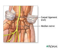 conventional-treatment-fourth-pic