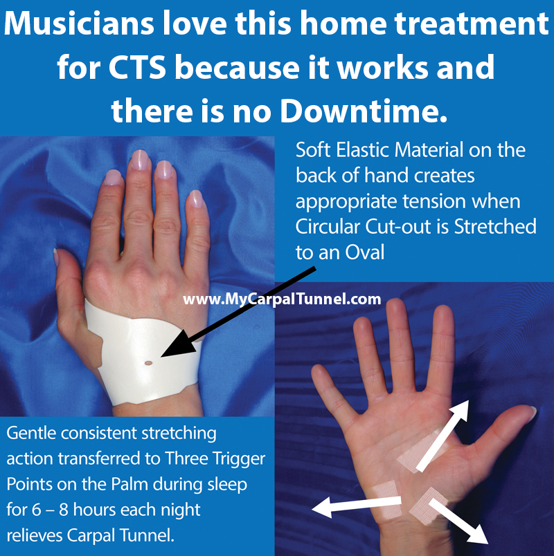 Musicians love this home treatment for CTS because it works and there is no Downtime