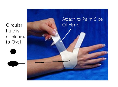 how-carpal-solution-works-2nd-pix