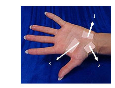 how the carpal solution works