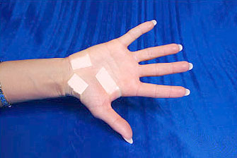 step-1C-cts-treatment step one for curing carpal tunnel syndrome