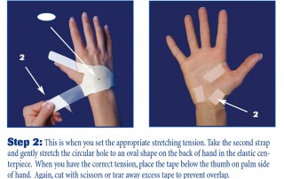 The second step to applying the carpal solution