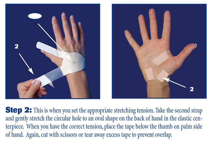 The second step to applying the carpal solution at the correct tension
