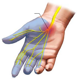 The Median Nerve