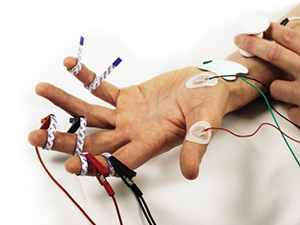 Nerve-conductivity-study-Carpal-Tunnel-Testing-