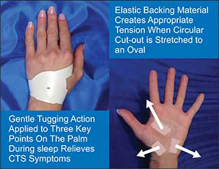 Get Carpal Tunnel Relief