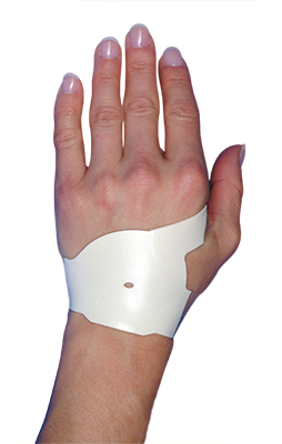 The Carpal Solution Therapy works for a high percentage of patients even after an unsuccessful surgery