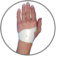the-carpal-option what are your options for treating cts