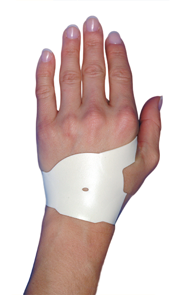 an effective alternative to a carpal tunnel cast is here
