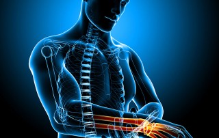 How does excessive, repetitive strain activity lead to numbness, tingling, nerve inhibition and sometimes even permanent nerve damage?