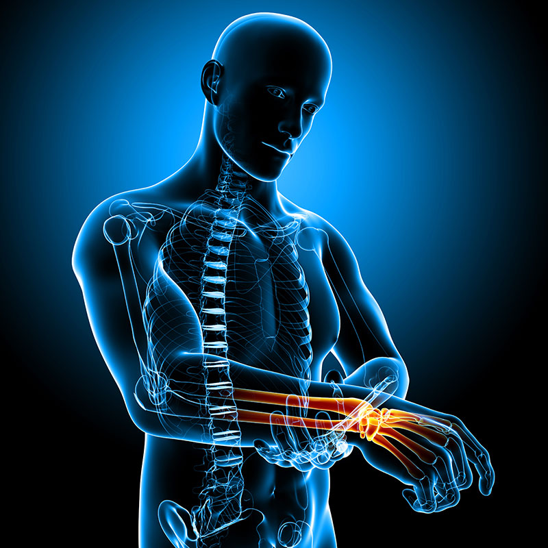 tingling-hands How does excessive, repetitive strain activity lead to numbness, tingling, nerve inhibition and sometimes even permanent nerve damage?