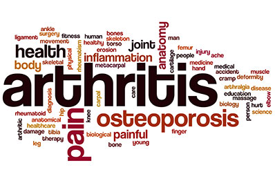 word cloud for symptoms that could lead to carpal tunnel syndrome