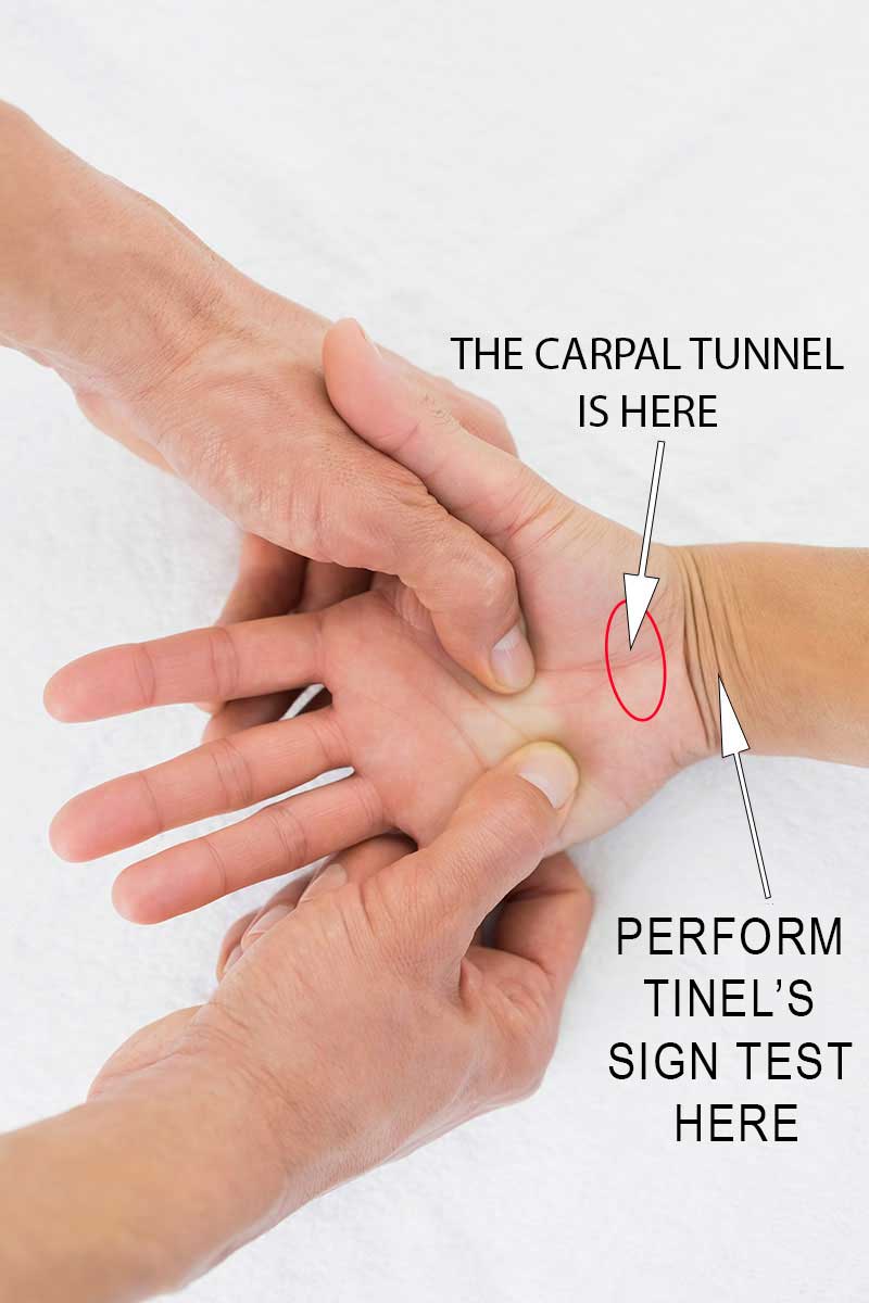 tinels-sign-test Sign self test for carpal tunnel