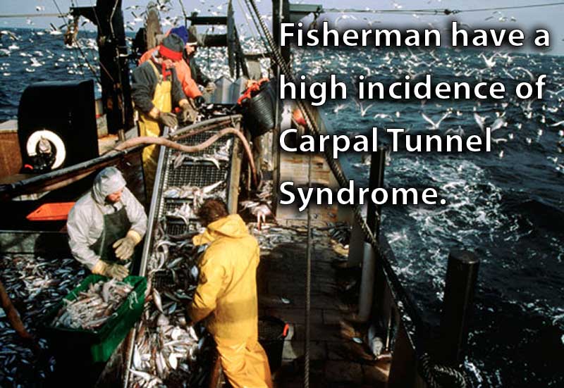Fisherman have a high Incidence of Carpal Tunnel Syndrome.