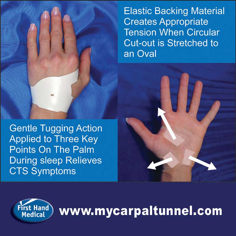 symptoms of carpal tunnel