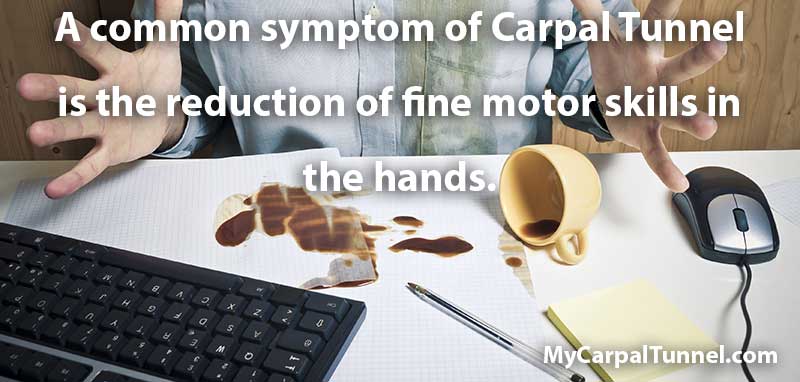carpal-tunnel-fine-motor-skills a common symptom of carpal tunnel is the reduction of fine motor skills in the hands