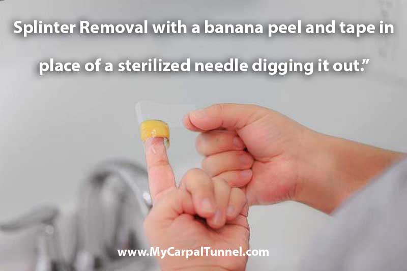 splinter removal with banana peel and tape