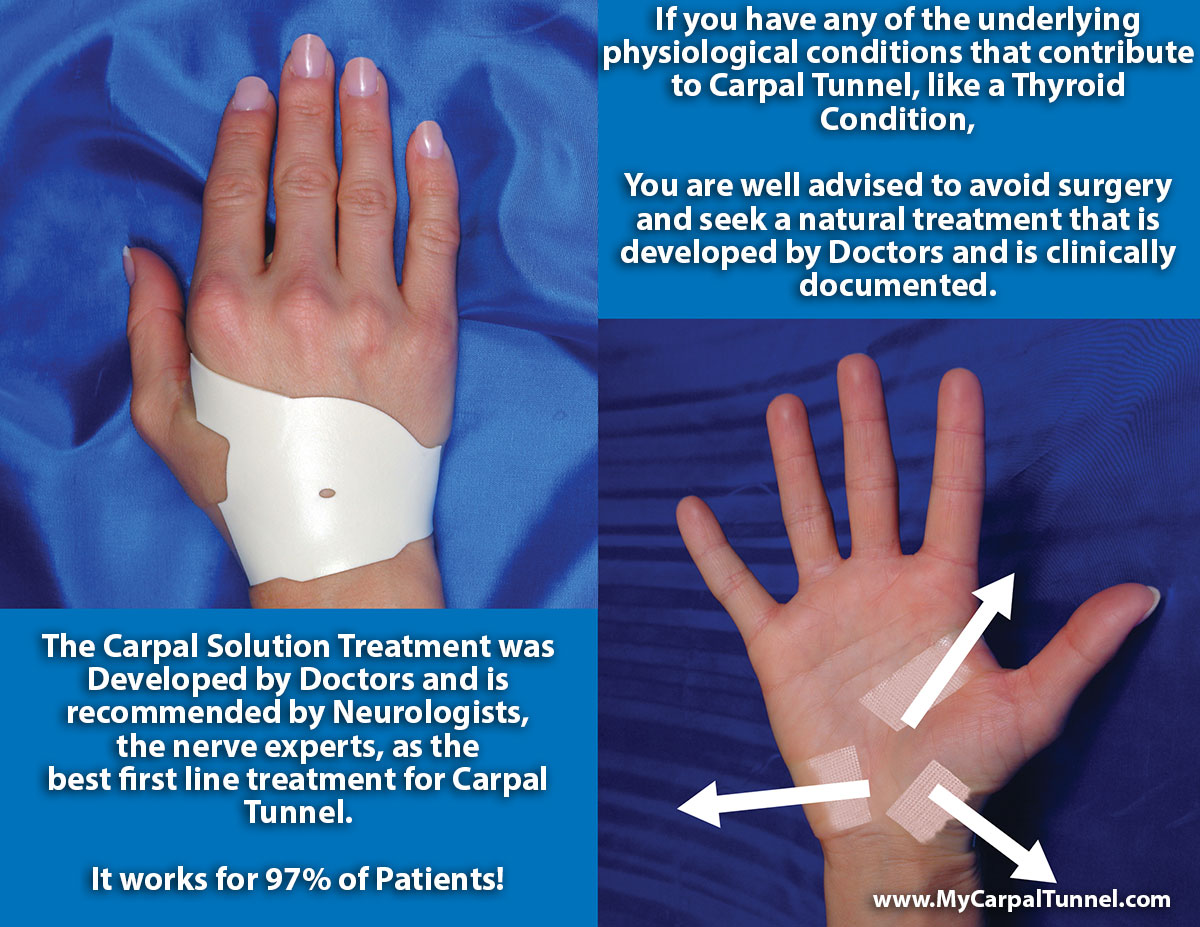 carpal-solution-hand-front-and-back You are well advised to avoid surgery and seek a natural treatment that is developed by Doctors and is clinically documented
