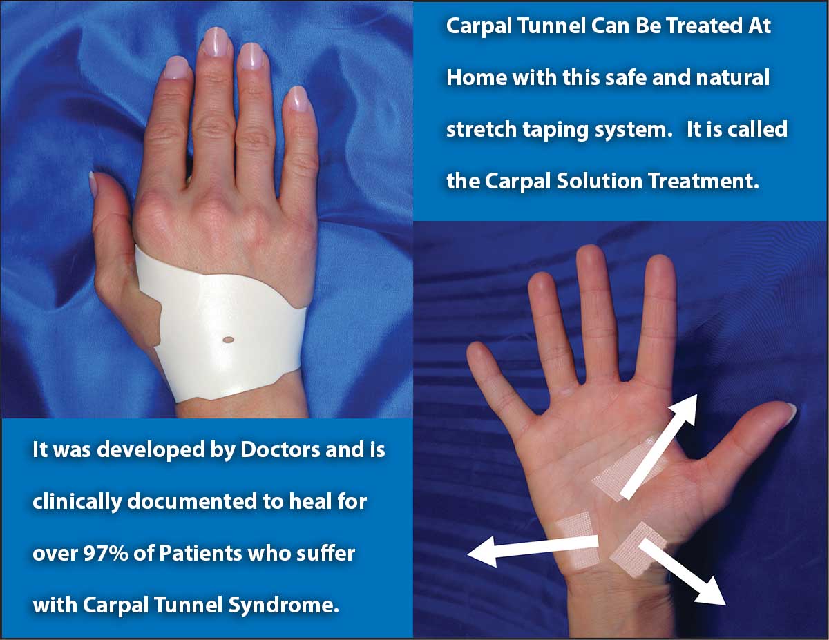 carpal-tunnel-treated-at-home carpal tunnel can be treated at home with a safe and natural stretch taping system