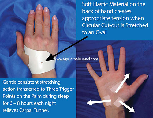 The Carpal Solution stretches and tugs at three key points on the hand