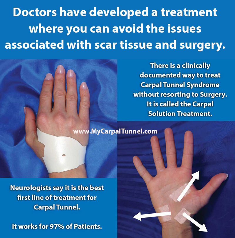 avoid-scar-tissue-and-carpal-tunnel-surgery Doctors have developed a treatment where you can avoid the issues associated with scar tissue and surgery.