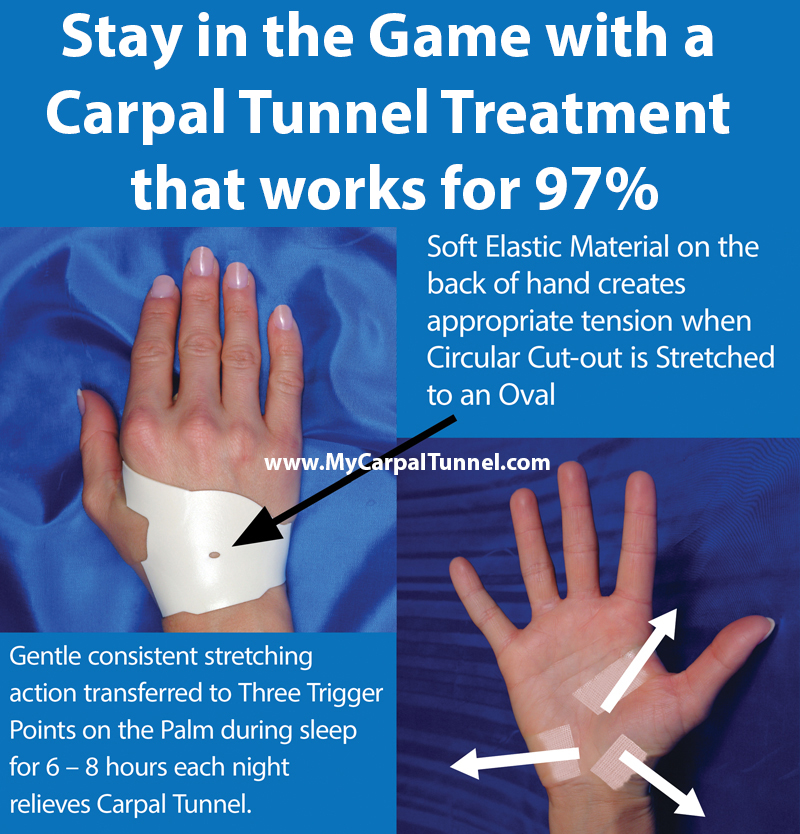 Stay in the Game with a Carpal Tunnel Treatment that works for 97%