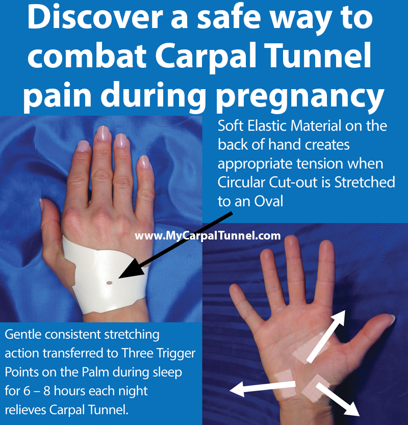 Discover a safe way to combat Carpal Tunnel pain during pregnancy