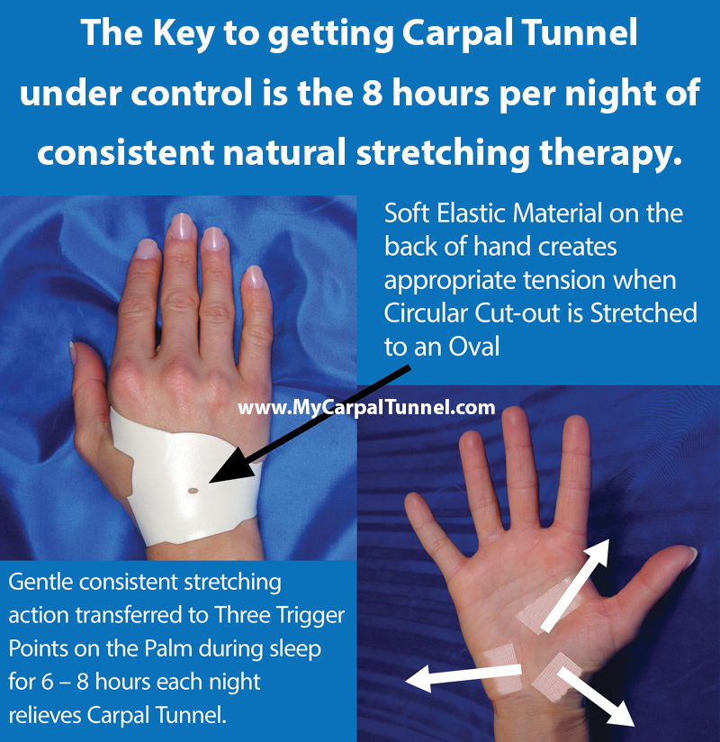 The Key to getting Carpal Tunnel under control is the 8 hours per night of consistent natural stretching therapy