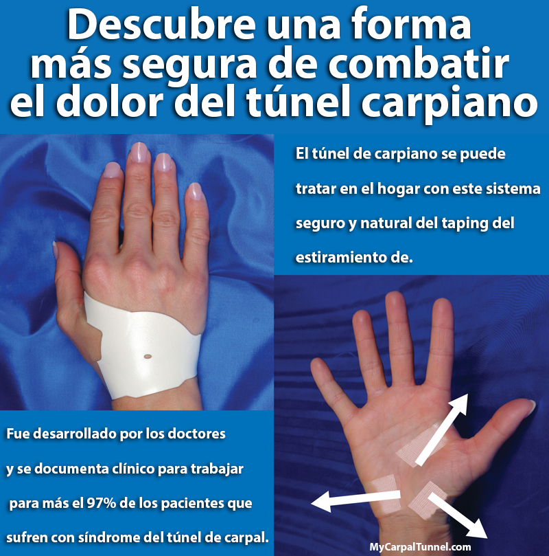 tratamiento por sindrome del tunel carpiano