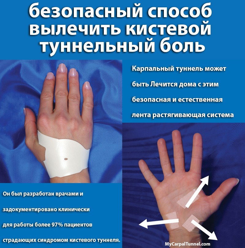 a cure for carpal tunnel is now available in russia