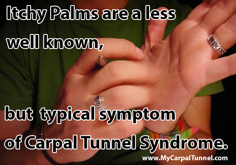 itchy palms and carpal tunnel syndrome