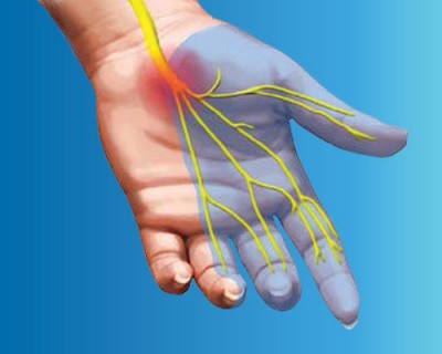 hand pain nerve path carpal tunnel treatment