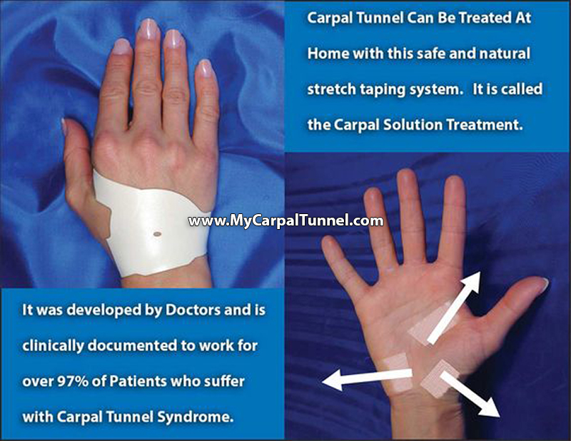 carpal tunnel can be treated at home with this safe and natural taping system