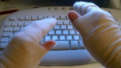 carpal tunnel surgery on both hands is not recommended