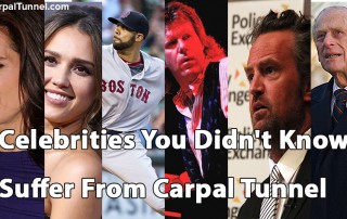 celebrities with carpal tunnel