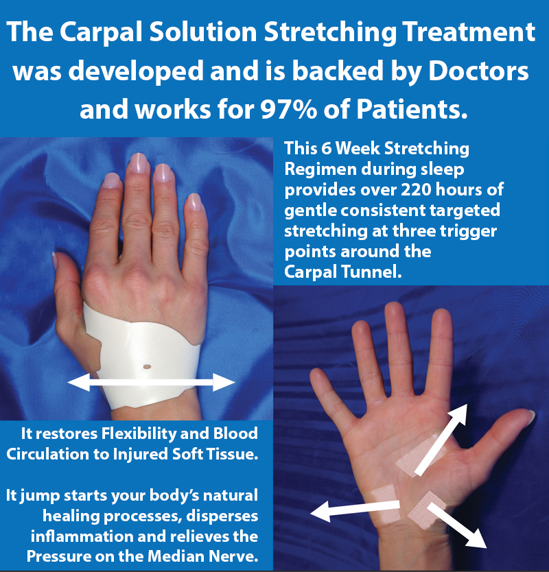 The Carpal Solution Nighttime Stretching Treatment provides over 220 hours of gentle, consistent and targeted stretching 