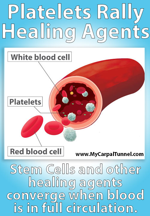 Platelets Rally Healing Agents
