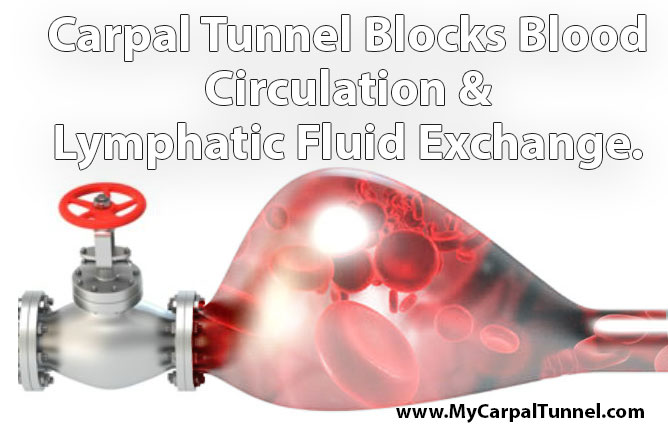 Carpal Tunnel Blocks Blood Circulation