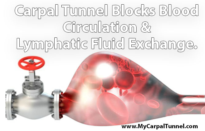 carpal-tunnel-blocks-blood-circulation Carpal Tunnel Blocks Blood Circulation