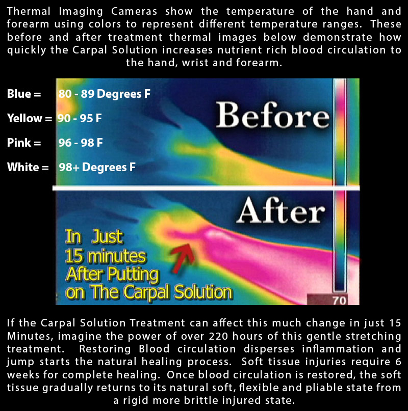 thermal imaging demonstrating the effects of the carpal solution