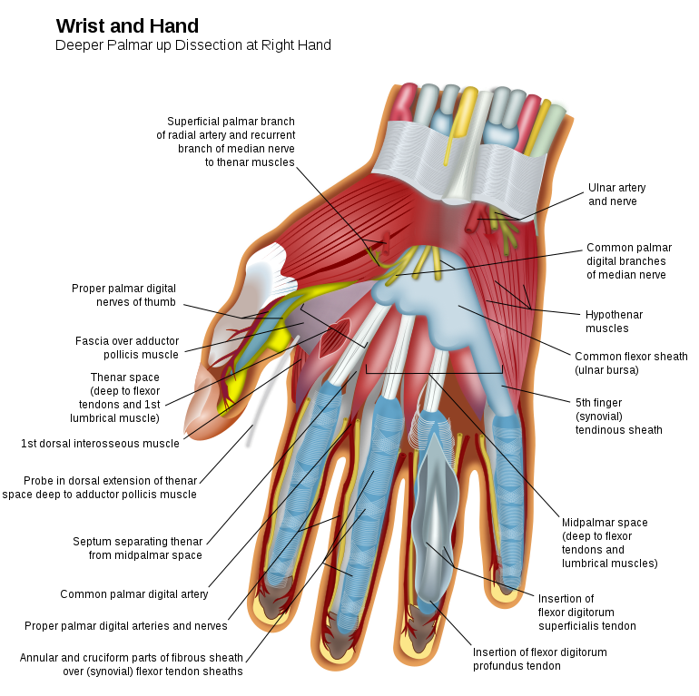 Hand Muscles can atrophy with onset of carpal tunnel syndrome thenar muscles and hypothenar muscle groups mycarpaltunnel
