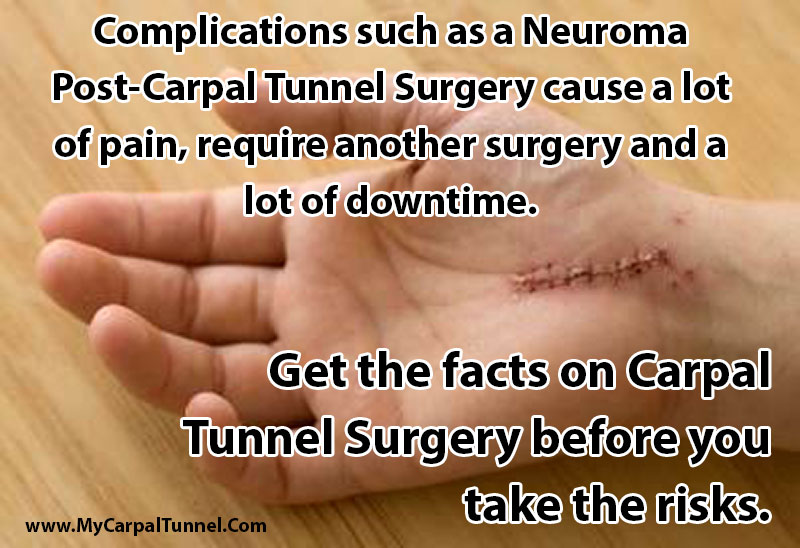 get the facts on neuroma and carpal tunnel surgery