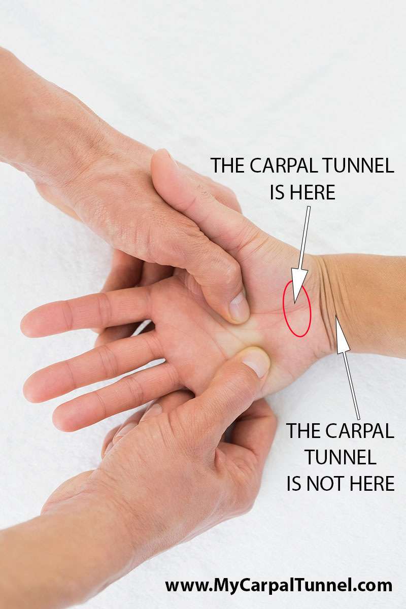 where is carpal tunnel wrist or base of hand location of the carpal tunnel anatomically