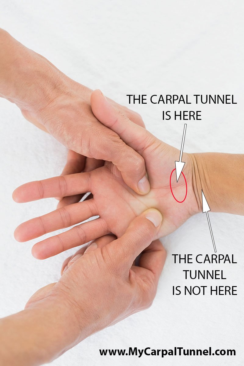 where-is-carpal-tunnel-wrist-or-base-of-hand-location-of-the-carpal-tunnel-anatomically-mycarpaltunnel where is carpal tunnel wrist or base of hand location of the carpal tunnel anatomically