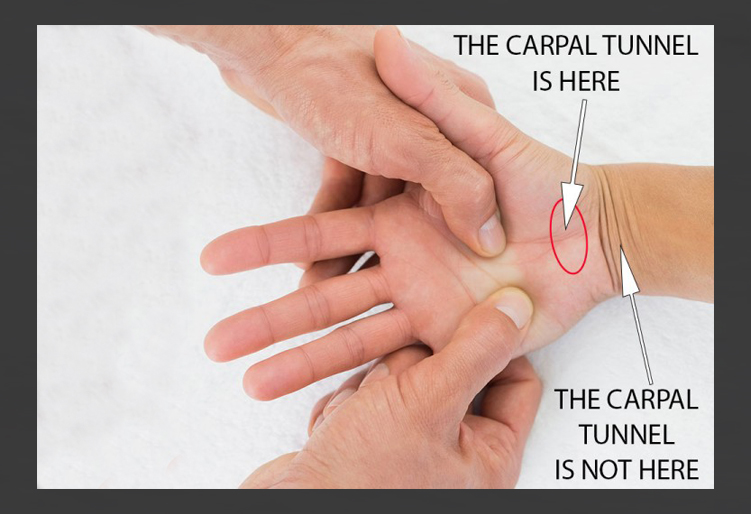 Where is the Carpal Tunnel Anatomically? In the Hand or in the Wrist