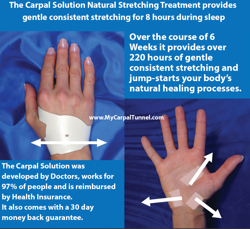 how the carpal solution works