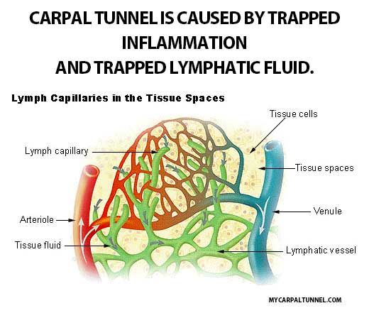 Lymphatic fluid exchange is key to natural healing carpal tunnel syndrome transports toxins waste from injured tissue