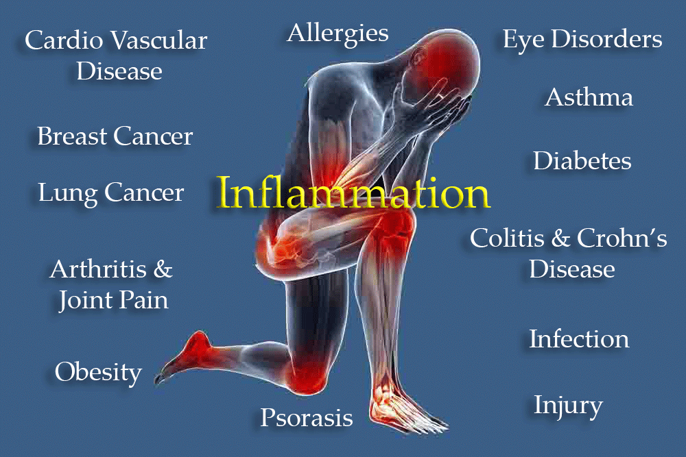 Inflammation drives carpal tunnel syndrome and most other chronic diseases afflicting the human race