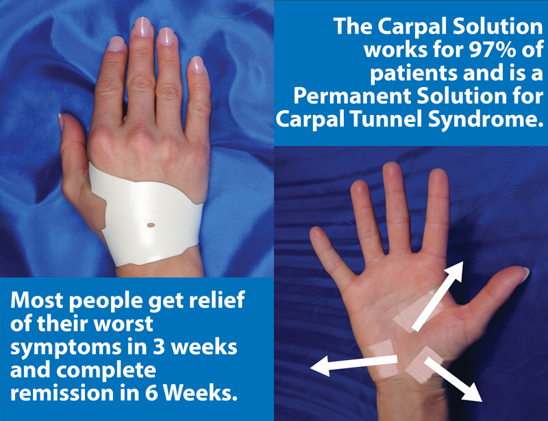 The Carpal Solution comes with a money Back Guarantee.